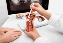 Tips for Successful At-Home Conception